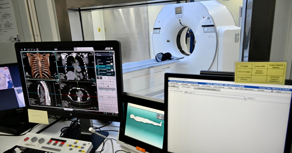 CT Scans and Cancer Risk: What You Need to Know – FYM News