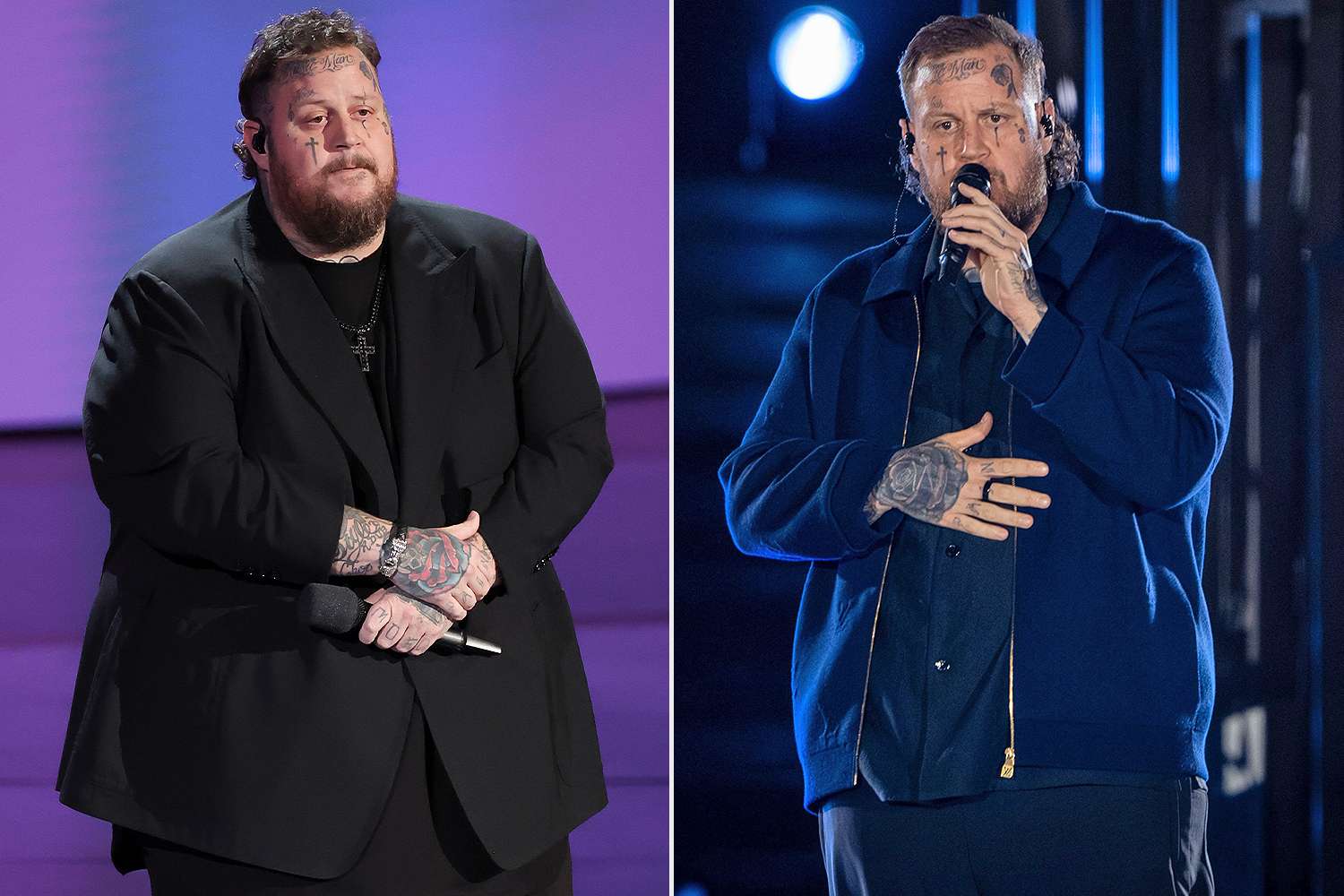 Jelly Roll’s Dramatic Weight Loss: Shows Off Louis Vuitton Outfit