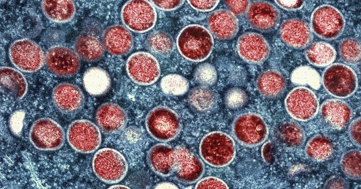 Mpox Strain Confirmed in L.A. County: What You Need to Know – FYM News